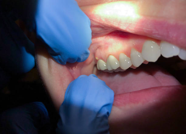 Best Cracked Tooth Emergency Dentist  in Eastport, NY